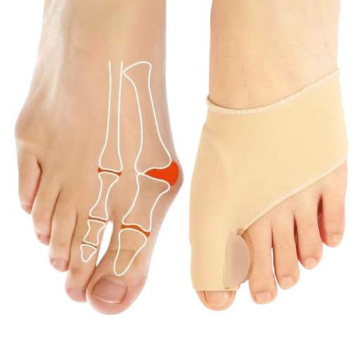 Ergonomiska Tåseparatorer för Hallux Valgus (2 st) – Stöd och Komfort