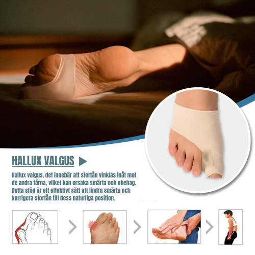 Ergonomiska Tåseparatorer för Hallux Valgus (2 st) – Stöd och Komfort