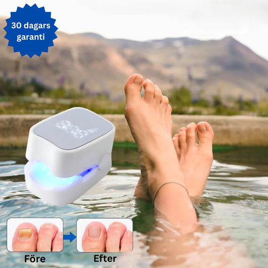 Smärtfri Nagelvårdslaser – Bärbar och Enkel Användning