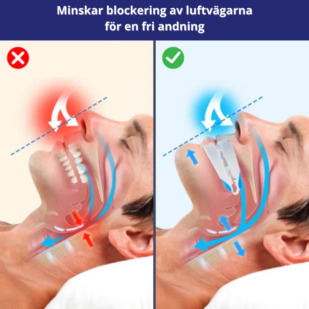 Snarkskena – effektiv mot snarkning