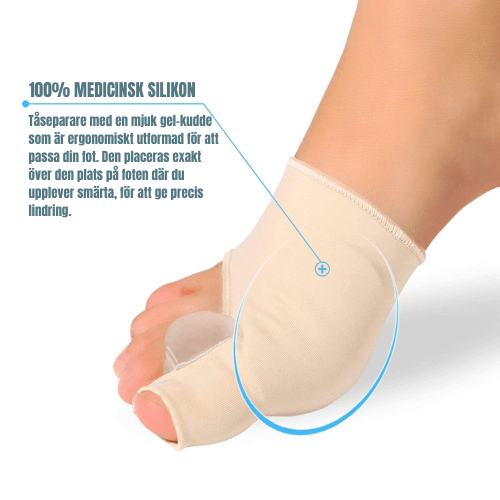 Ergonomiska Tåseparatorer för Hallux Valgus (2 st) – Stöd och Komfort