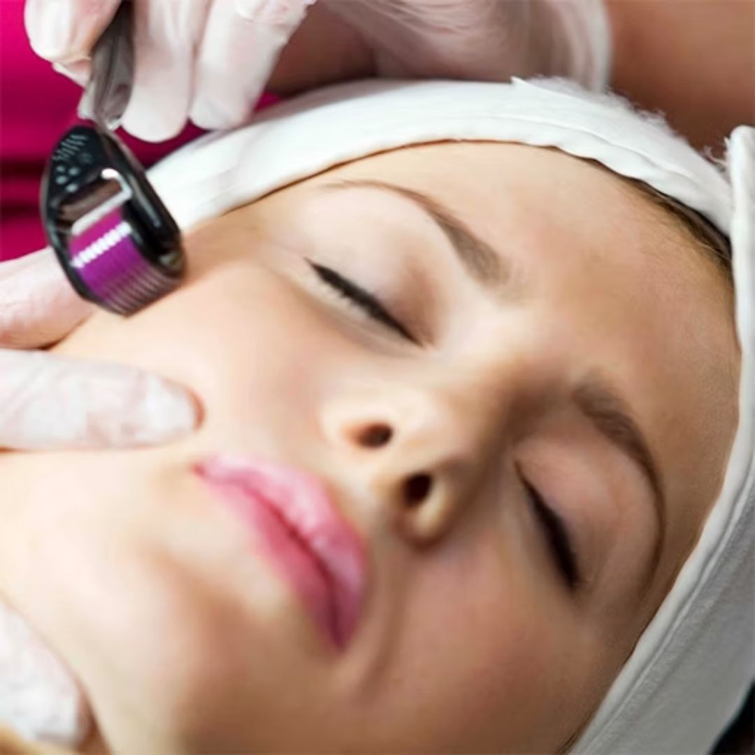 Dermaroller 1.0mm – Kollagen & hudförnyelse