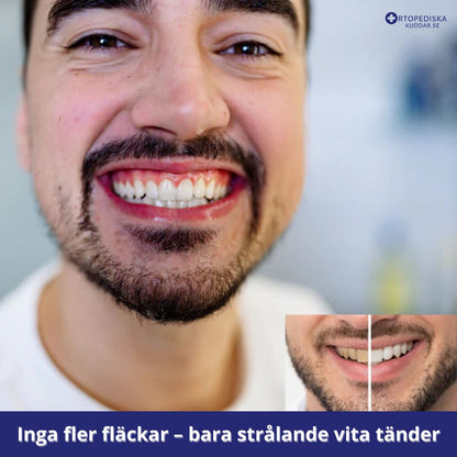 Helautomatisk Tandborste - Effektiv Tandrengöring